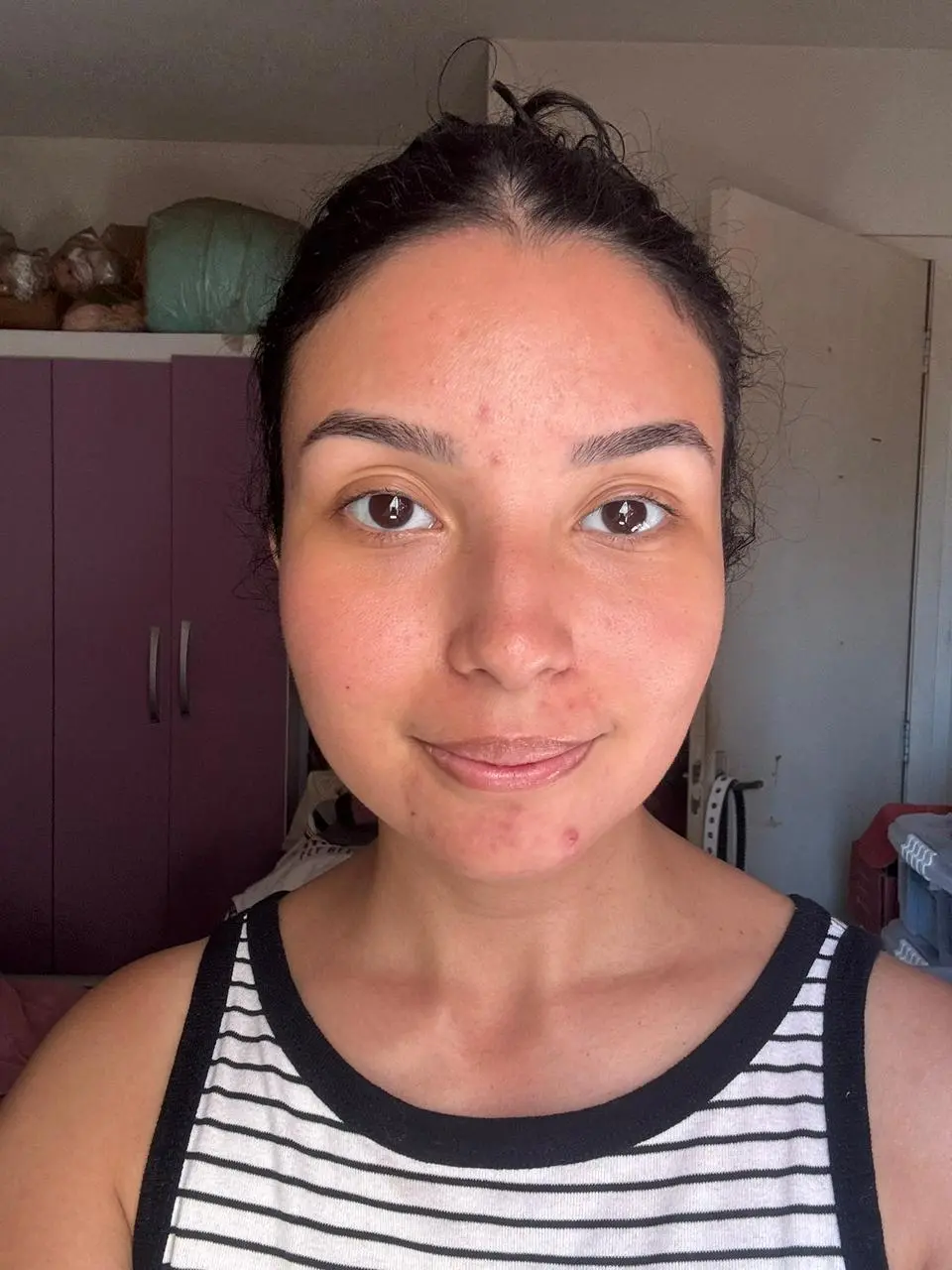 antes do uso do Sérum Facial & Olhos Vó Irene